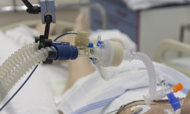 Νοσοκομείο “Σωτηρία”: 32 ετών χωρίς υποκείμενα νοσήματα ο νεαρότερος ασθενής στη ΜΕΘ