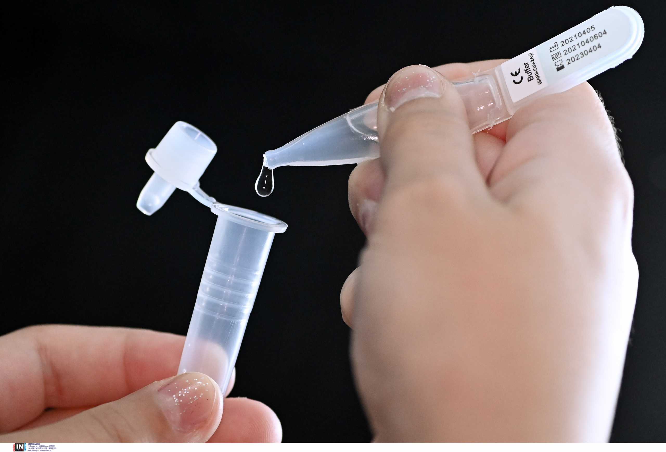Σκέρτσος: Τότε θα εξαιρεθούν από το self testing οι εμβολιασμένοι – Τι είπε για τη δεύτερη δόση εμβολίου των νοσούντων