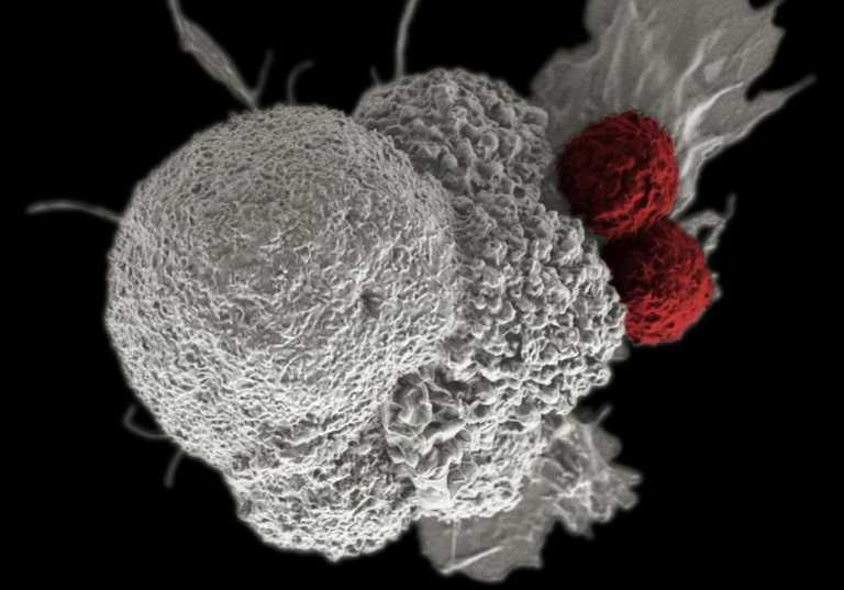 The largest blood test to detect 50 types of cancer begins