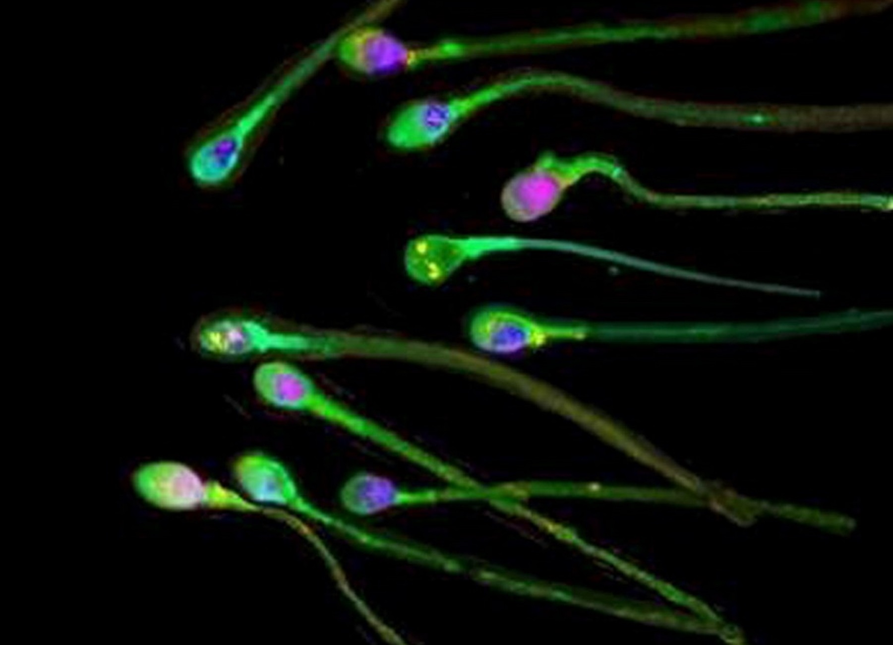 Πόσο επηρεάζουν το σπέρμα τα εμβόλια mRNA: Τι δείχνουν οι έρευνες