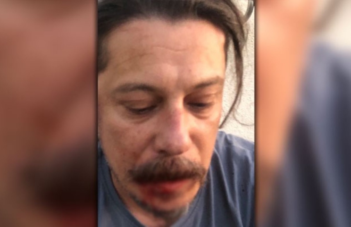 Γερμανία: Θύμα άγριας επίθεσης Τούρκος δημοσιογράφος επικριτής του Ερντογάν