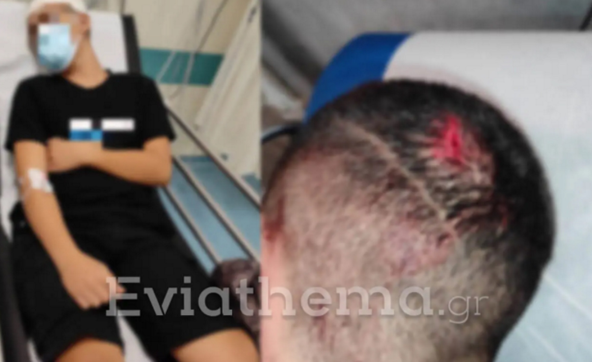 Αλιβέρι: 15χρονος σοβαρά τραυματισμένος στο κεφάλι από επίθεση 21χρονου κατόχου «μαύρης ζώνης»