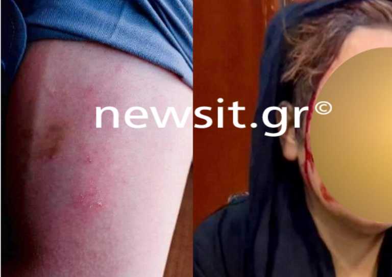 Το newsit.gr στη διαδήλωση των ατρόμητων γυναικών στην Καμπούλ - Αποκλειστικές εικόνες από την επίθεση των Ταλιμπάν