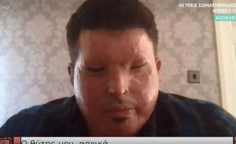 Ιωάννα Παλιοσπύρου: Το μήνυμα που δέχθηκε από θύμα επίθεσης από οξύ