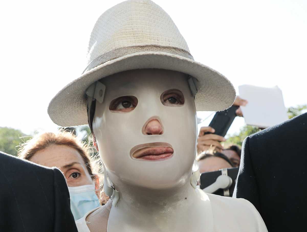 Επίθεση με βιτριόλι στην Ιωάννα Παλιοσπύρου: Η πολύκροτη δίκη και η μάσκα «σύμβολο» δύναμης