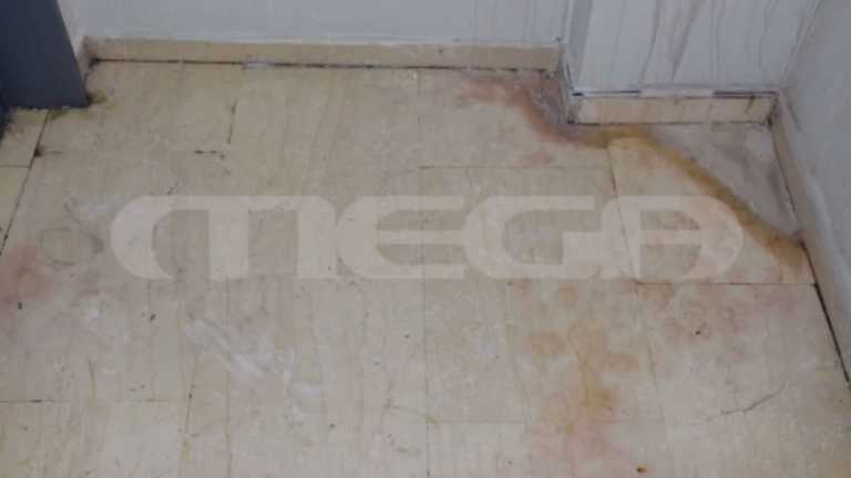 Επίθεση με βιτριόλι: Αδημοσίευτες φωτογραφίες αμέσως μετά την τραγωδία – Νέοι διάλογοι φωτιά