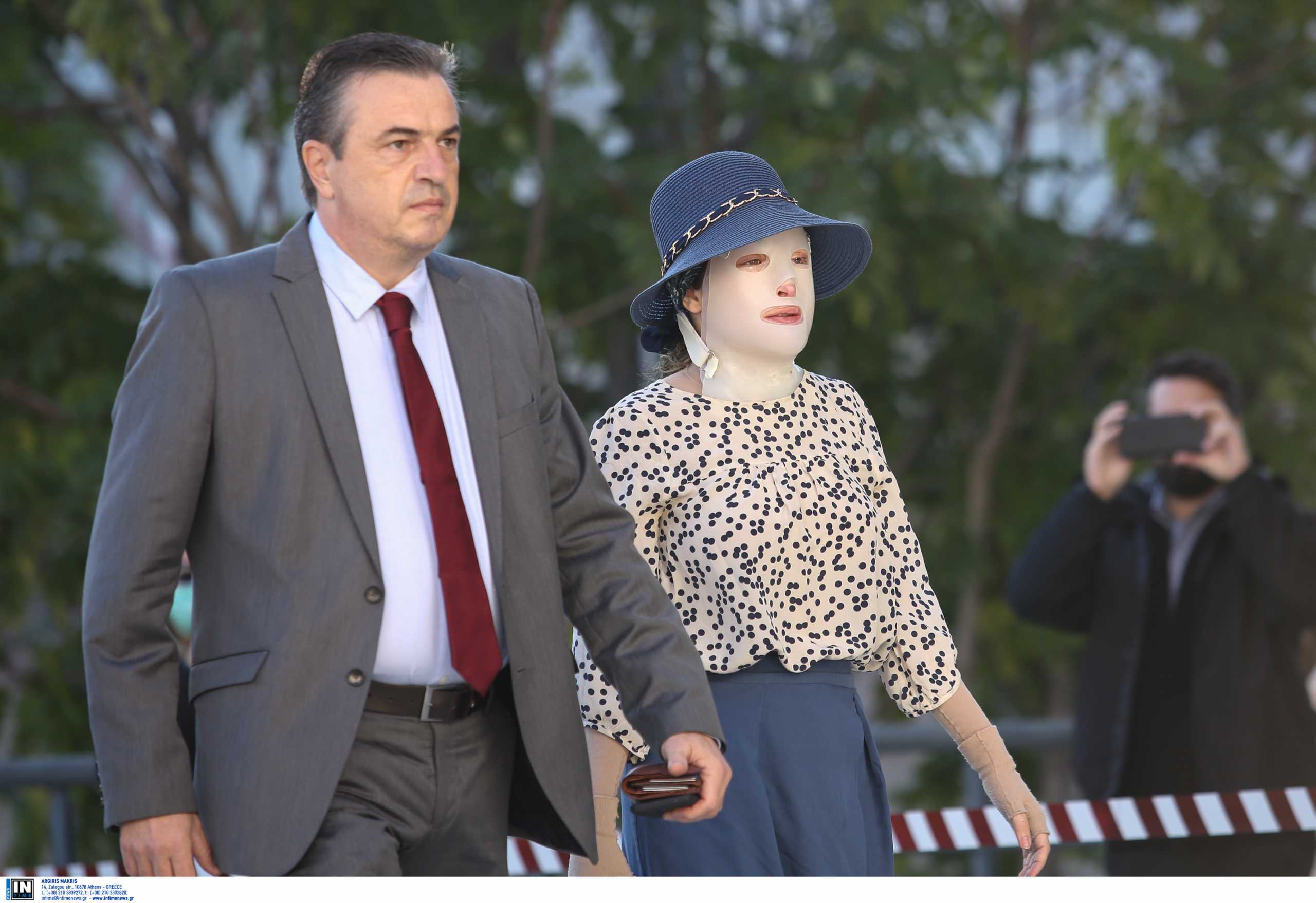 Επίθεση με βιτριόλι: «Η Ιωάννα Παλιοσπύρου ήρθε ουρλιάζοντας στο νοσοκομείο» – 400 βαθμοί Κελσίου η θερμοκρασία των τραυμάτων της