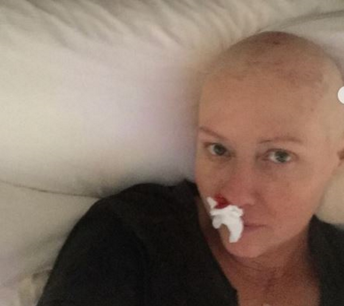 Σάνεν Ντόχερτι: Η σκληρή μάχη της ηθοποιού με τον καρκίνο – «Είναι αυτές οι φωτογραφίες όμορφες;»