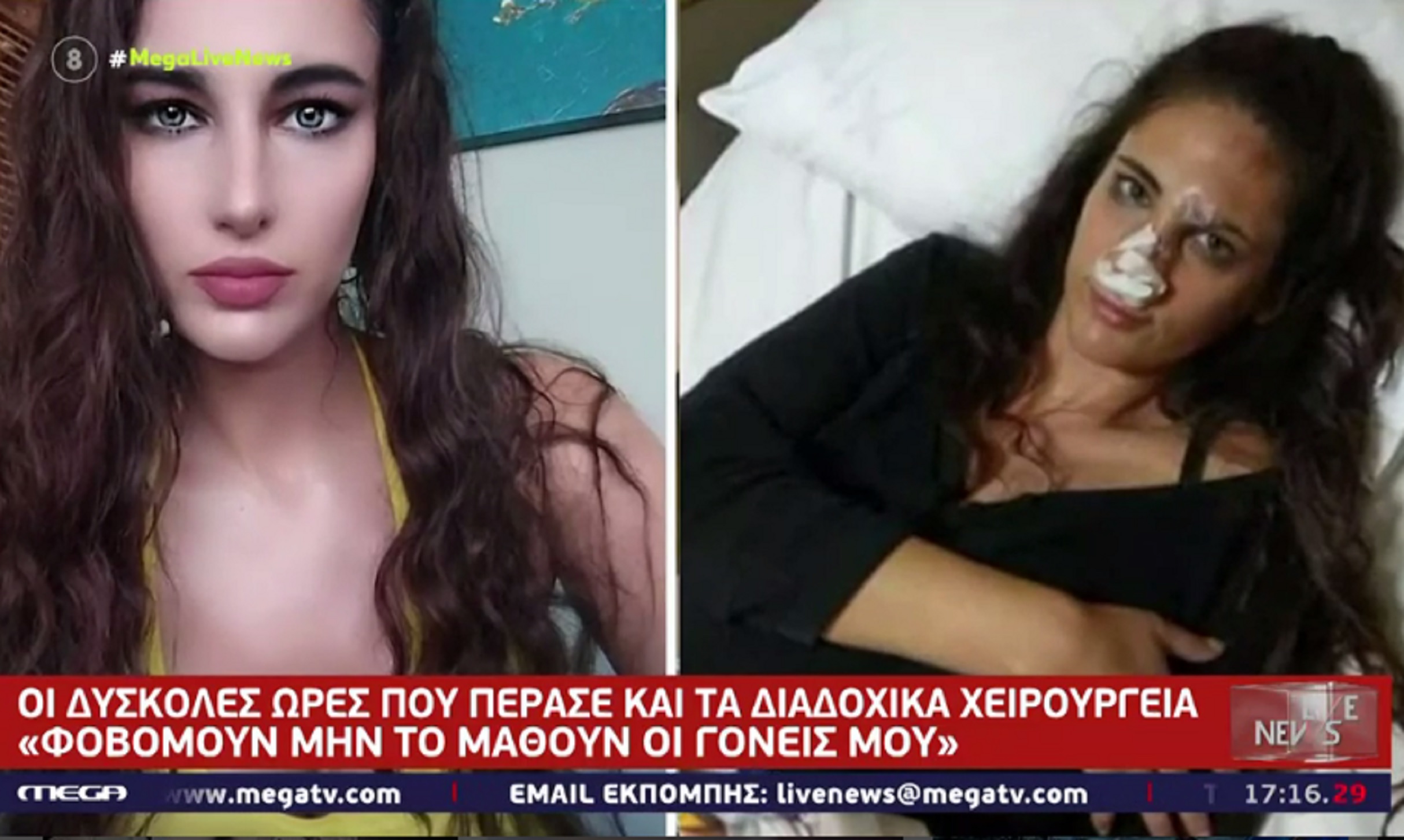 Ναστάζια Μητροπούλου: «Έσπασε η σπονδυλική μου στήλη από τις κλωτσιές» – Ο ξυλοδαρμός από την πρώην σύντροφό της