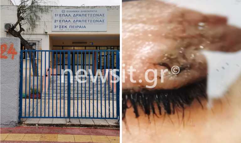 ΕΠΑΛ Δραπετσώνας: Η 16χρονη έσβησε το τσιγάρο στο μάτι συμμαθήτριάς της για... ένα αγόρι - «Δεν το έχει μετανιώσει»