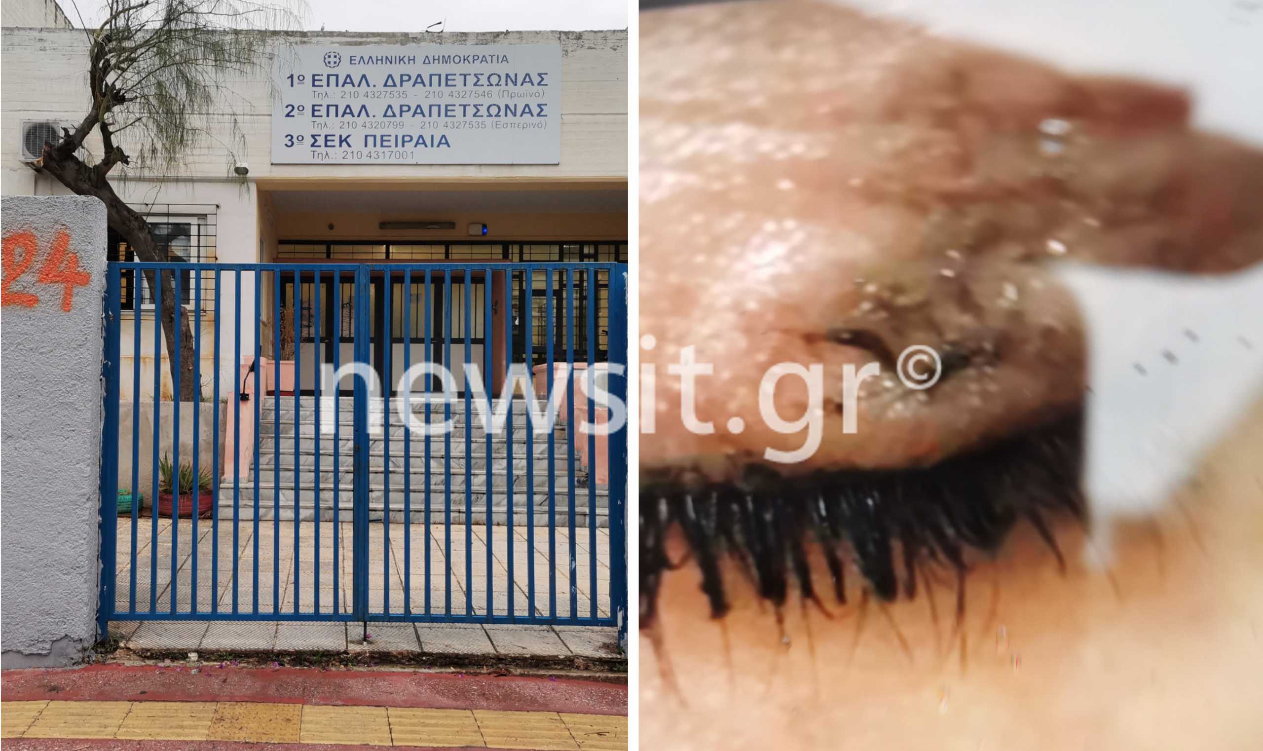 ΕΠΑΛ Δραπετσώνας: Η 16χρονη έσβησε το τσιγάρο στο μάτι συμμαθήτριάς της για… ένα αγόρι