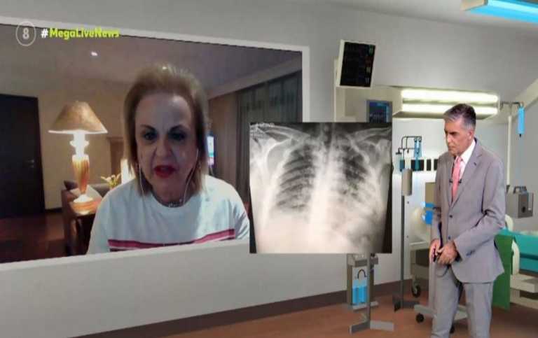 Ματίνα Παγώνη: Εικόνες που τα «λένε» όλα για τη βλάβη που προκαλεί ο κορονοϊός στα πνευμόνια