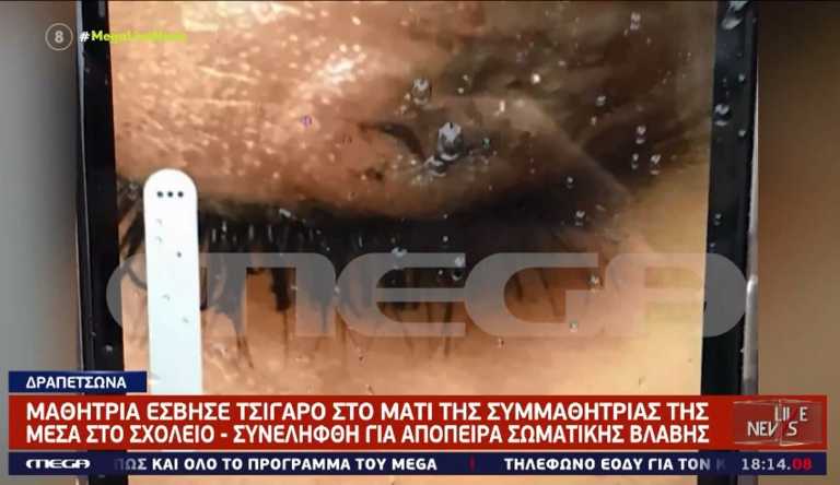 Δραπετσώνα: Συνελήφθη η 16χρονη που έσβησε τσιγάρο στο μάτι συμμαθήτριας της – Εικόνες ντοκουμέντα από το τραύμα