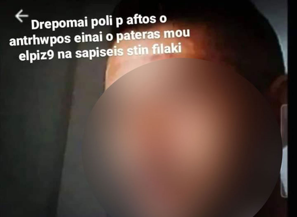 Αργυρούπολη: «Τη χτύπησα αλλά δεν ήθελα να τη στείλω στο νοσοκομείο» – Τι είπε ο 46χρονος στους αστυνομικούς