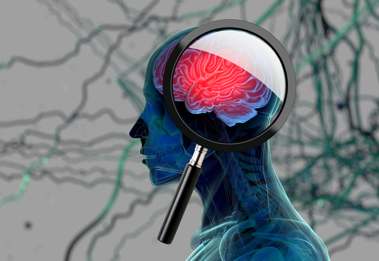 Ηράκλειο: Ένα βήμα πιο κοντά στην εξιχνίαση της λειτουργίας του εγκεφάλου βρίσκονται ερευνητές του ΙΤΕ