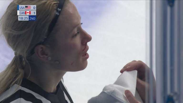 Χειμερινοί Ολυμπιακοί Αγώνες: Δέχθηκε το μπαστούνι στο πρόσωπο κι αποχώρησε με αίματα