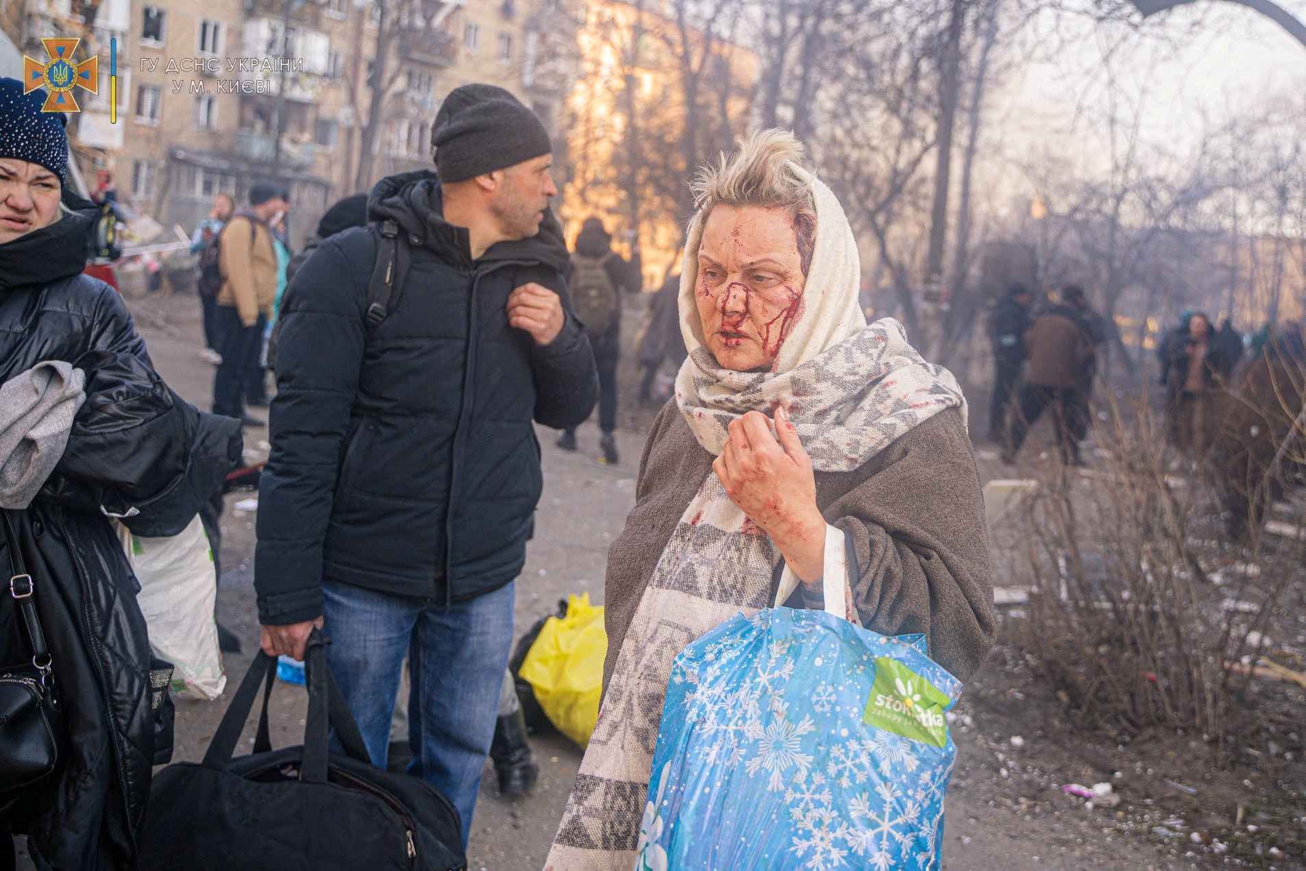 SENSITIVE MATERIAL. THIS IMAGE MAY OFFEND OR DISTURB    An injured woman walks during evacuation from a building damaged by shelling, as Russia's attack on Ukraine continues, in Kyiv, Ukraine, in this handout picture released March 18, 2022.  Press service of the State Emergency Service of Ukraine