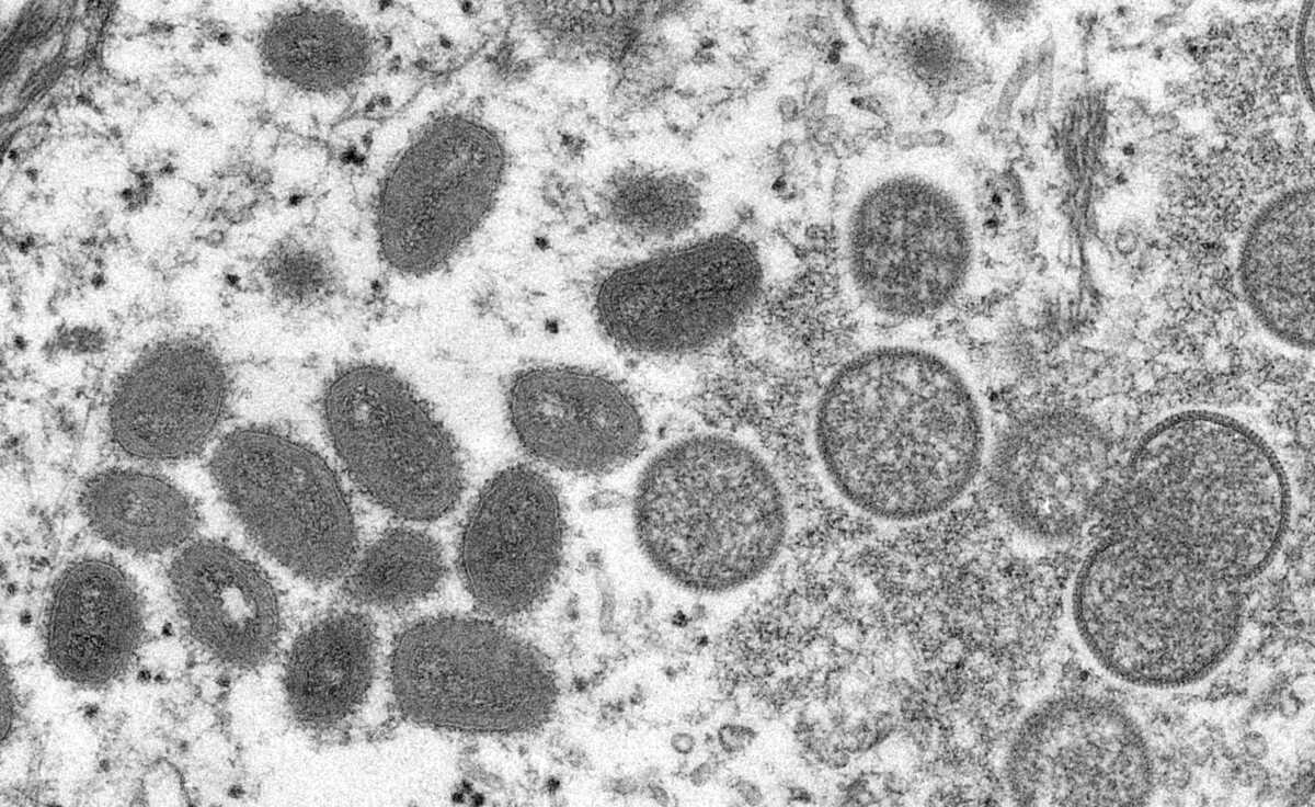 Ευλογιά των πιθήκων: Φόβοι για έξαρση του ιού από τον ΠΟΥ – Πως μεταδίδεται