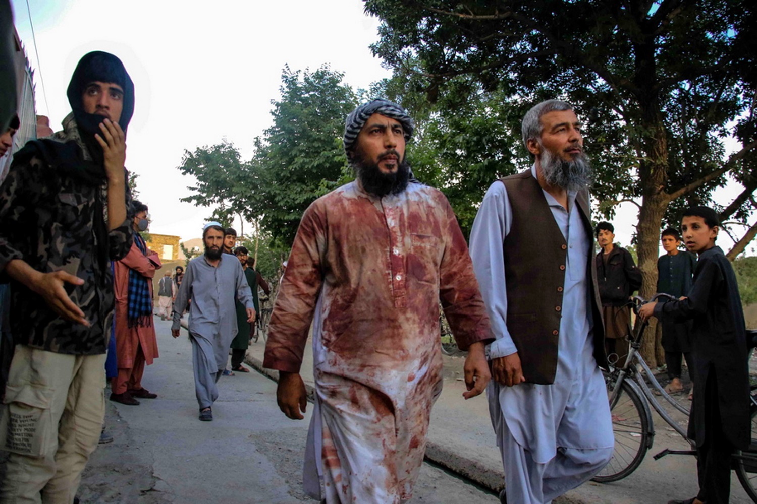 Αφγανιστάν: Αυξάνεται ο αριθμός των νεκρών από την έκρηξη σε τζαμί της Καμπούλ
