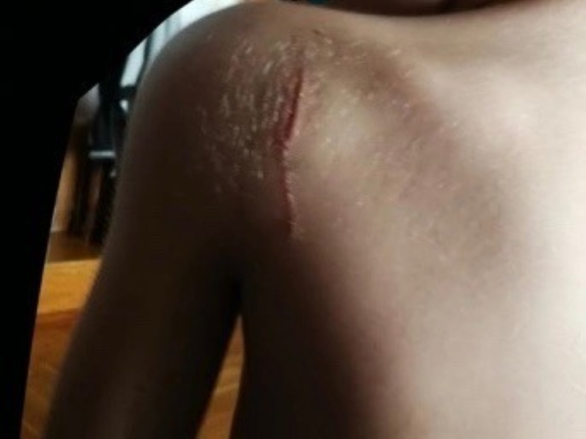 Θεσσαλονίκη: Μαχαίρωσαν μαθητή με φαλτσέτα μέσα στο σχολείο – Εικόνα ντοκουμέντο
