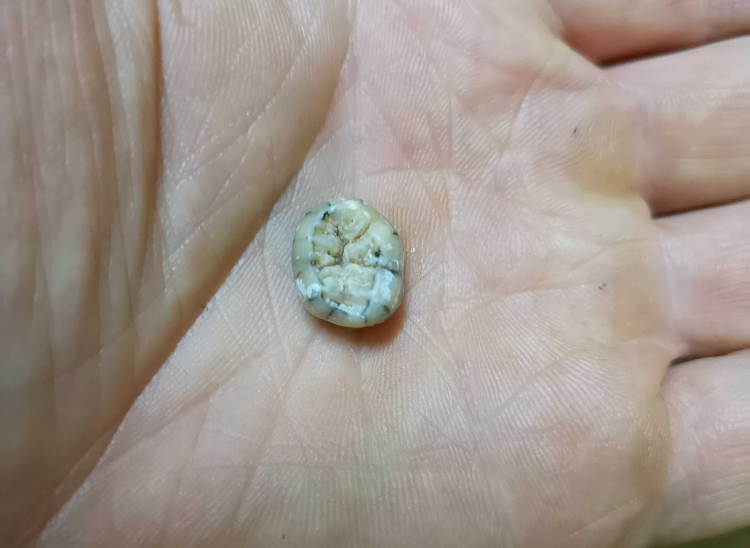 Ένα παιδικό δόντι 130.000 ετών «δίνει» απαντήσεις για τους ανθρώπους Ντενίσοβαν