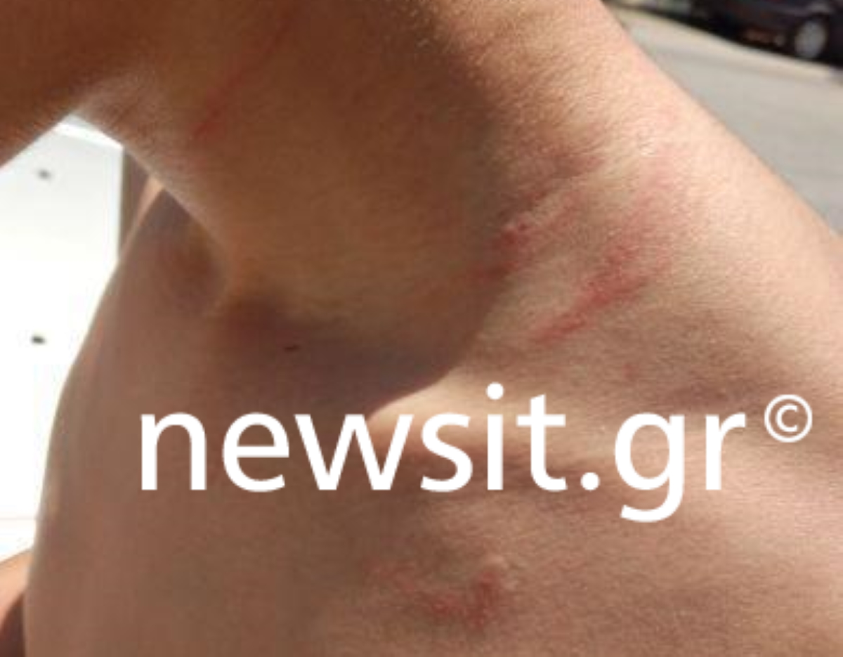 Σύλληψη καθηγήτριας: «Δεν έπρεπε να το κάνει αυτό στο παιδί» λέει η μητέρα στο newsit.gr