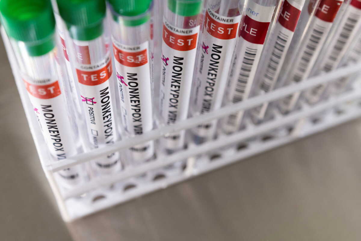 Ευλογιά των πιθήκων: Ο ΠΟΥ εξετάζει αν πρόκειται για «παγκόσμια έκτακτη ανάγκη» – Τι ισχύει για τους μαζικούς εμβολιασμούς