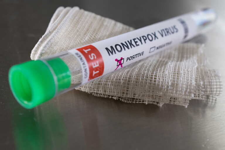 First death from monkey pox in Brazil