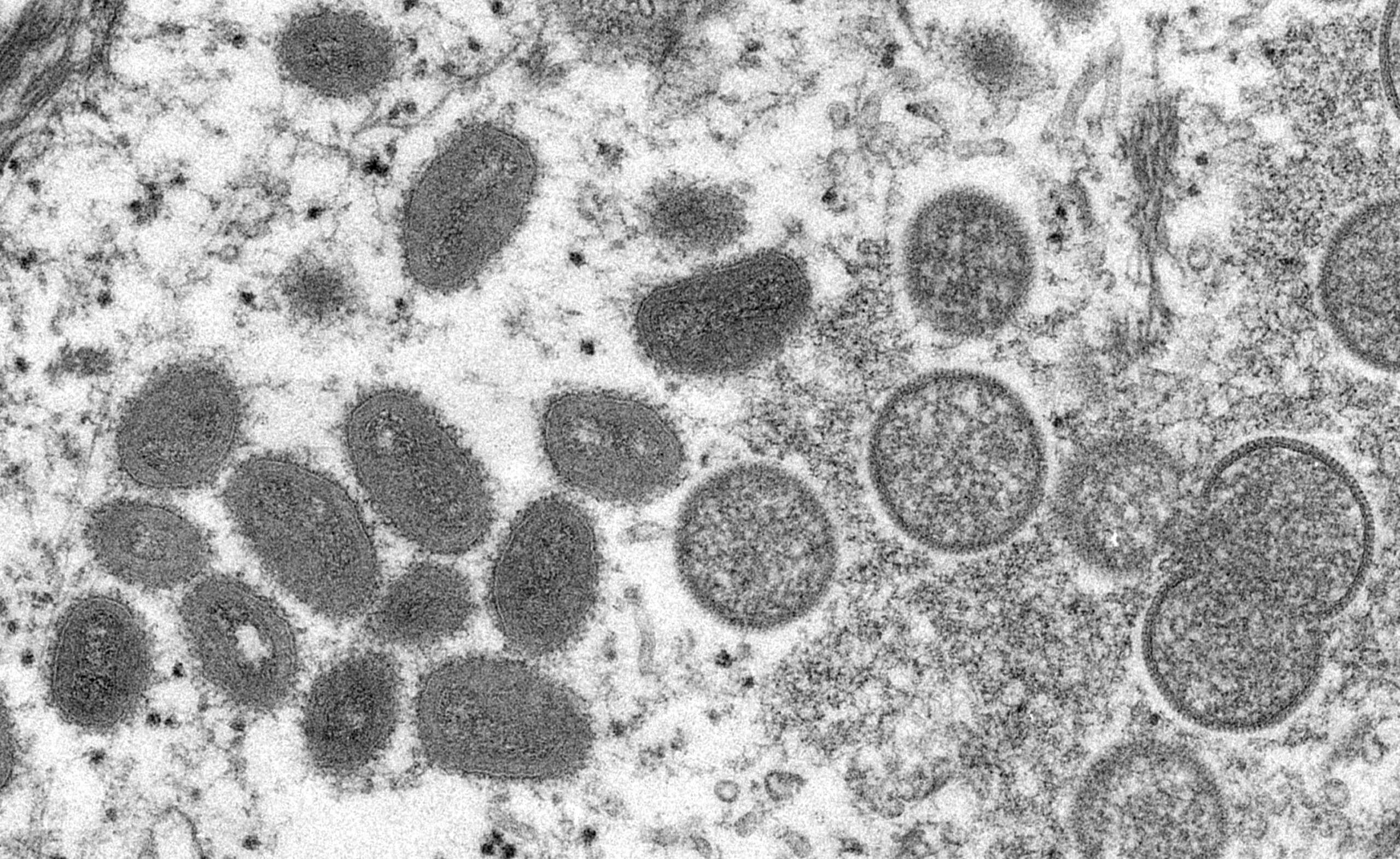 Μόσιαλος για ευλογιά των πιθήκων: Τι γνωρίζουμε ως τώρα για τον ιό