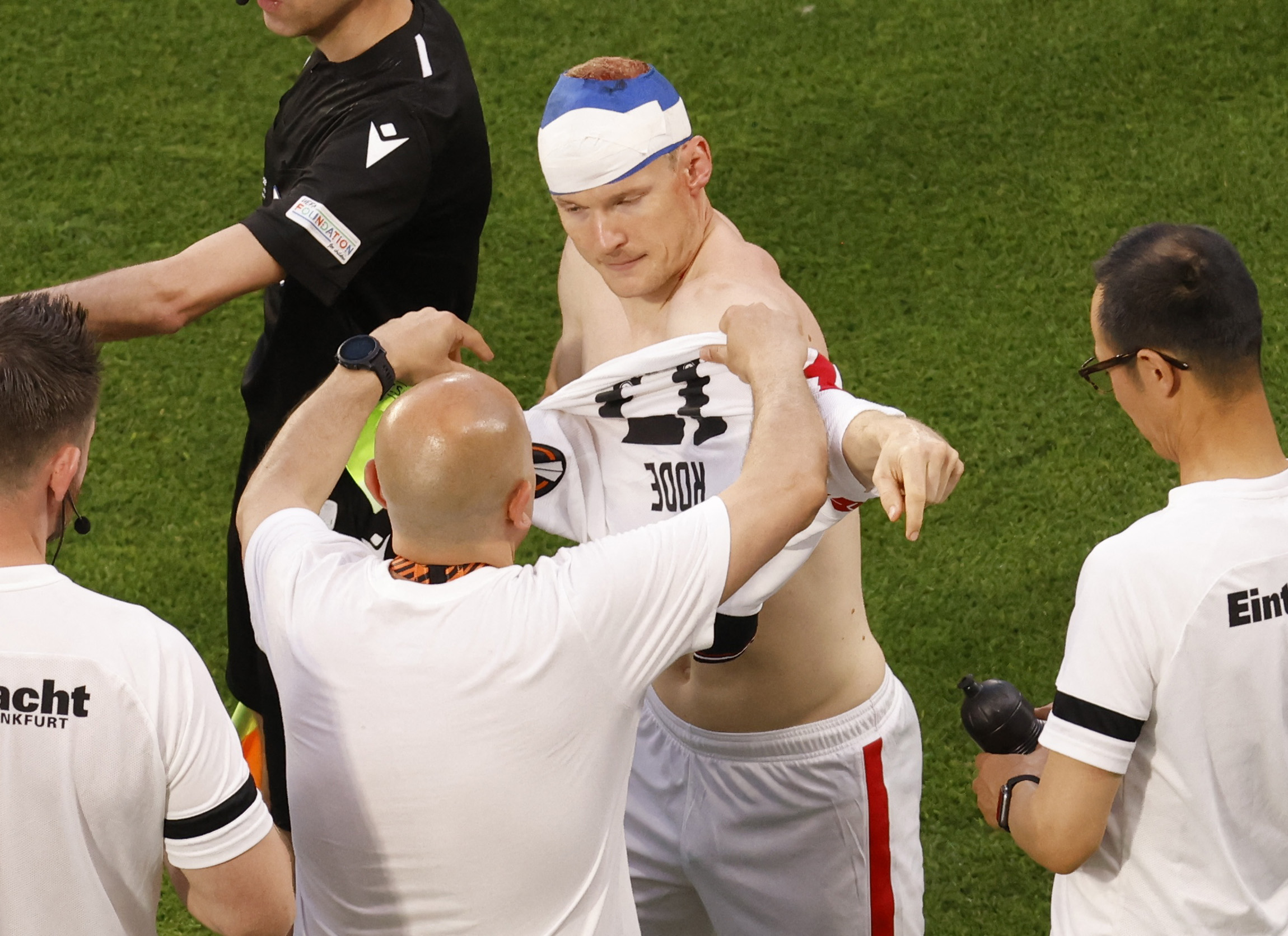 Τελικός Europa League: Η φωτογραφία του Ρόντε με τα ράμματα στο κεφάλι