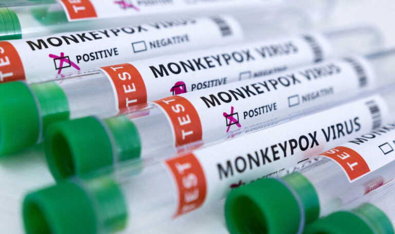 Smallpox: First Confirmed Cases in Bulgaria – Traveled to Spain, Britain