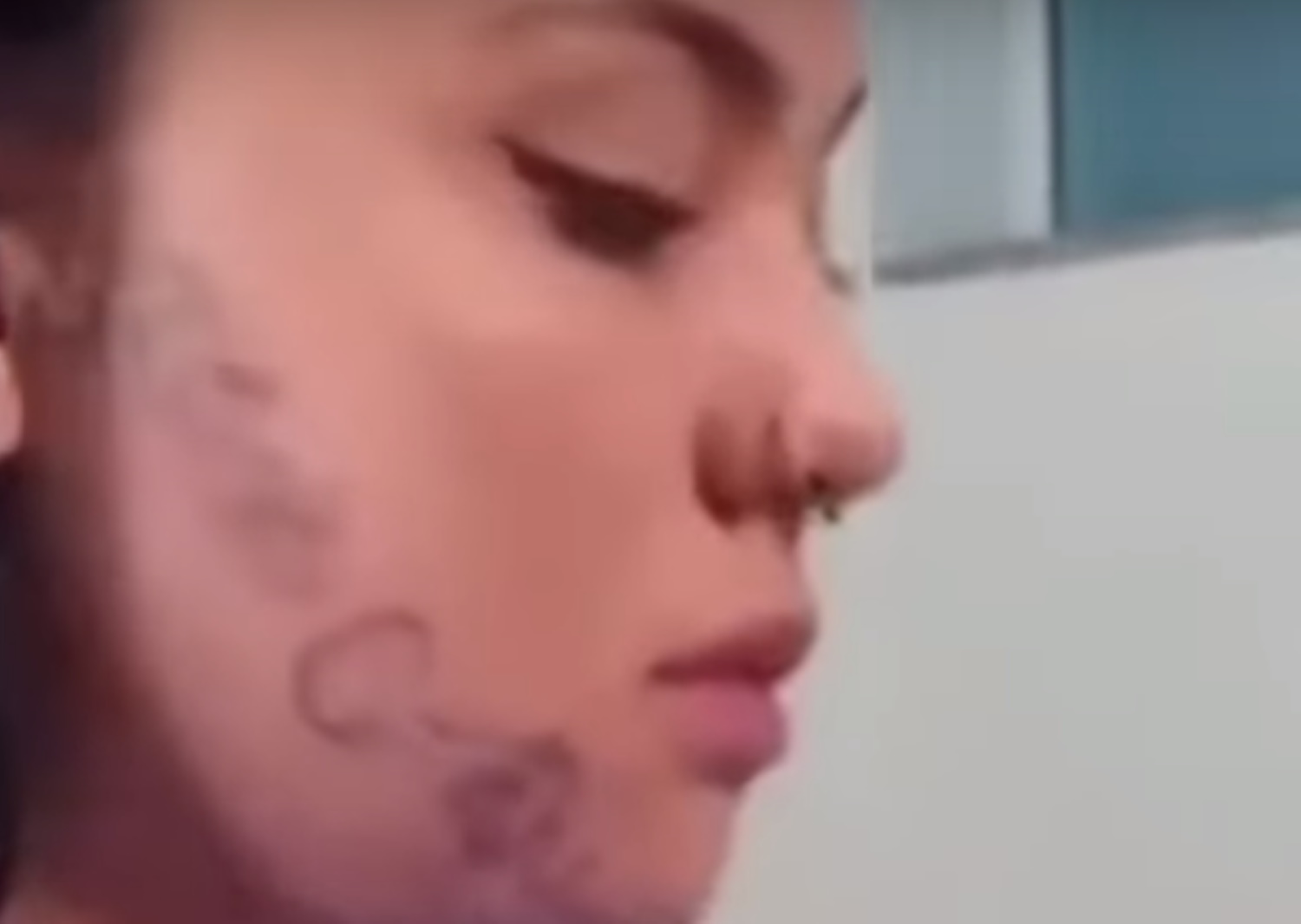 Βραζιλία: «Χτύπησε» τατουάζ το όνομά του στο πρόσωπό της για εκδίκηση επειδή τον χώρισε
