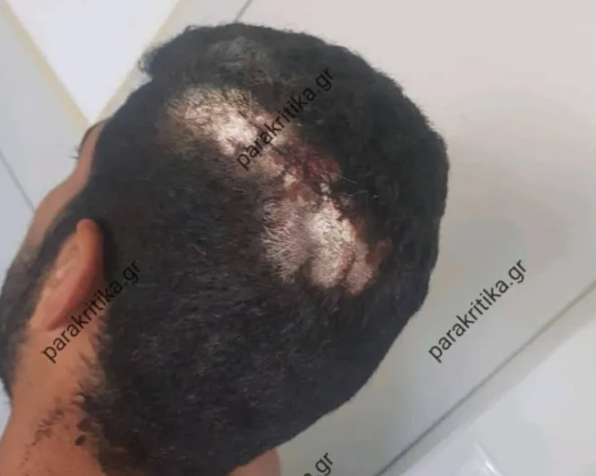 Χανιά: Ζήτησε από τον εργοδότη τα λεφτά του και παραλίγο να τον σκοτώσει