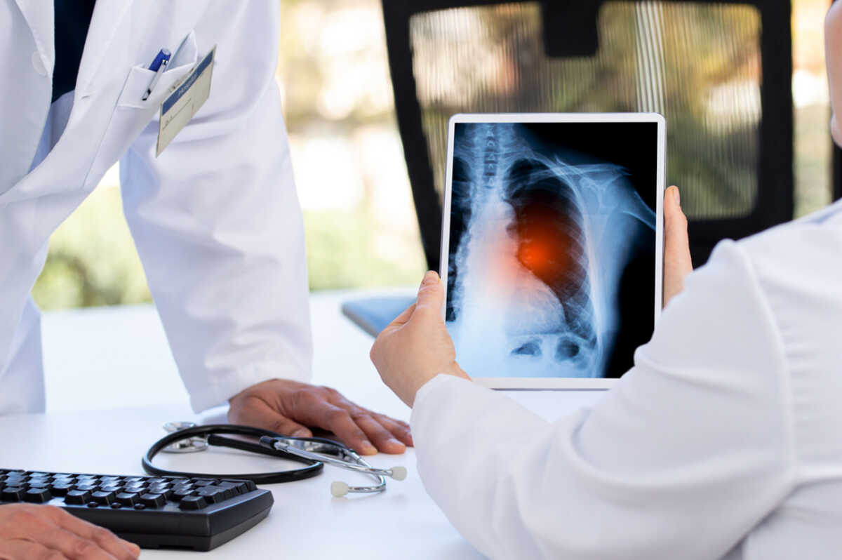Radiology and medicine concept. doctor explaining the results of scan lung on digital tablet screen to patient with long covid
