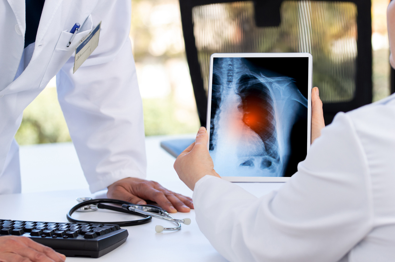 Radiology and medicine concept. doctor explaining the results of scan lung on digital tablet screen to patient with long covid