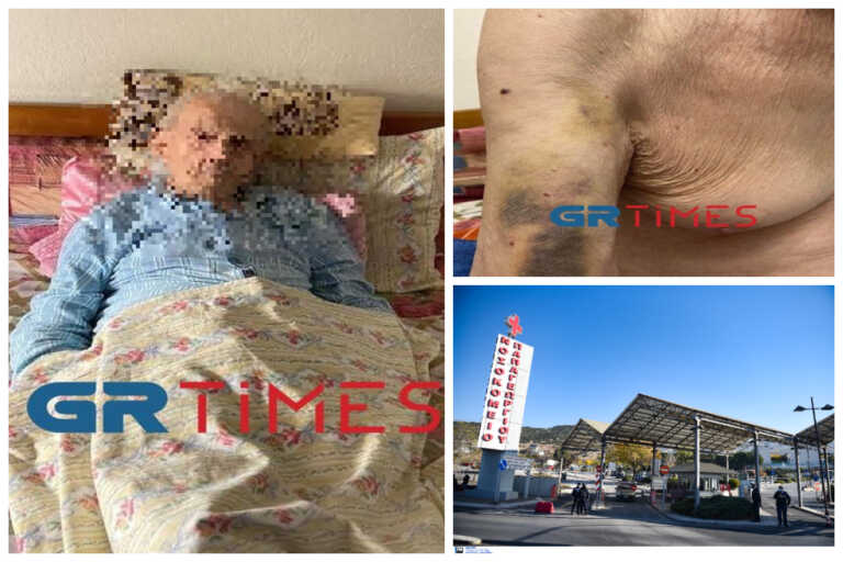 Καταγγελία για κακοποίηση 98χρονου στο «Παπαγεωργίου» Θεσσαλονίκης – «Οι μώλωπες οφείλονται σε αντιπηκτικά φάρμακα» λέει το νοσοκομείο
