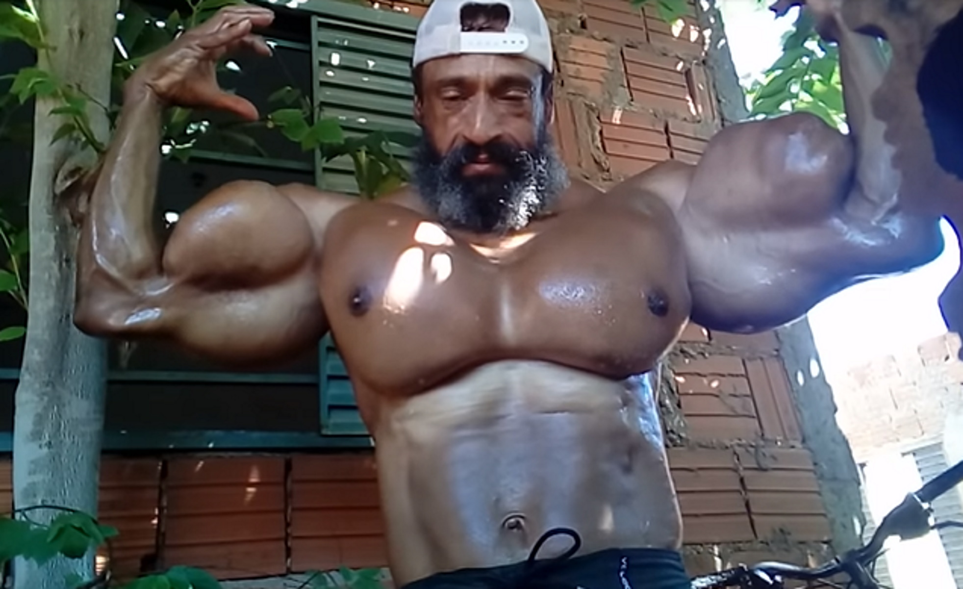 Πέθανε Βραζιλιάνος bodybuilder που έκανε ενέσεις λαδιού στους μύες – Ήθελε να γίνει σαν τον Σβαρτσενέγκερ