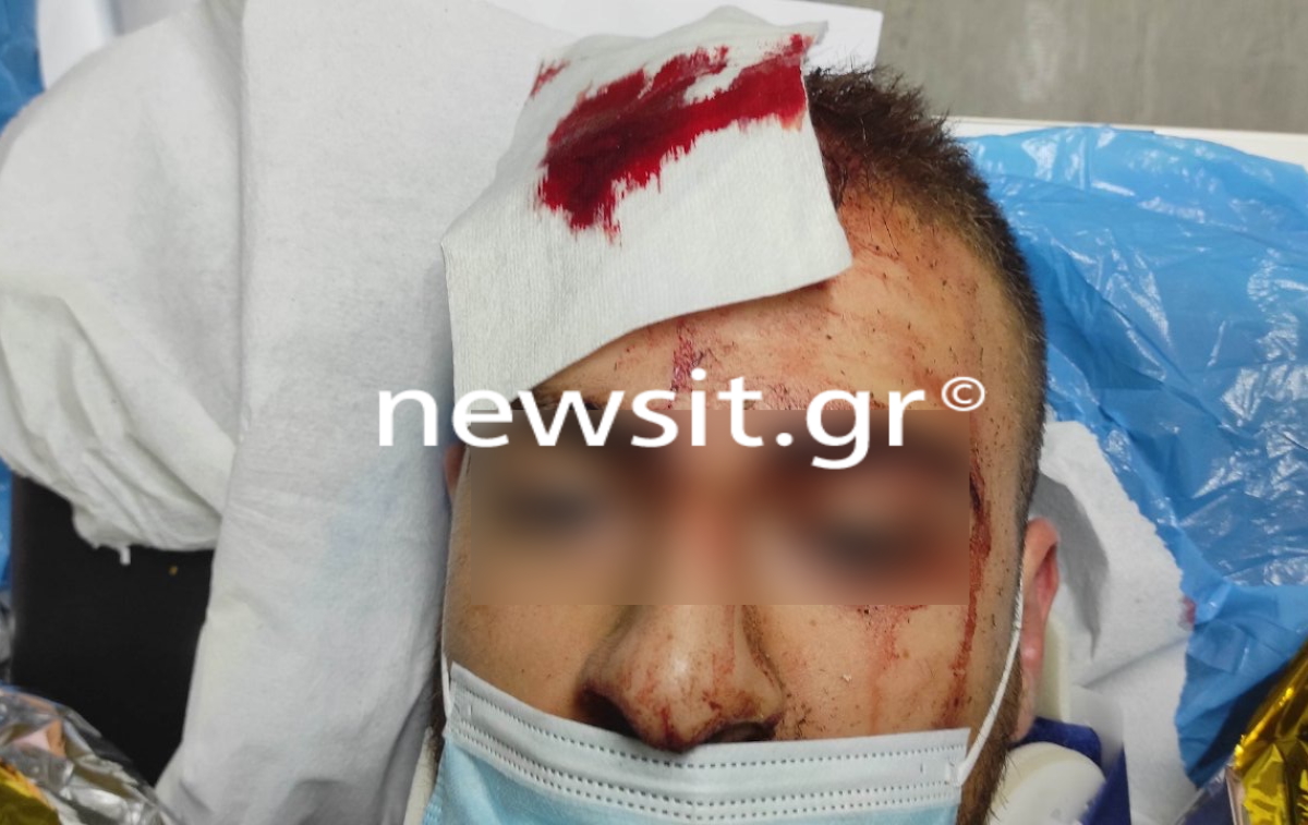 Allou! Fun Park: Φωτογραφίες του 25χρονου μέσα από το νοσοκομείο λίγη ώρα μετά το ατύχημα