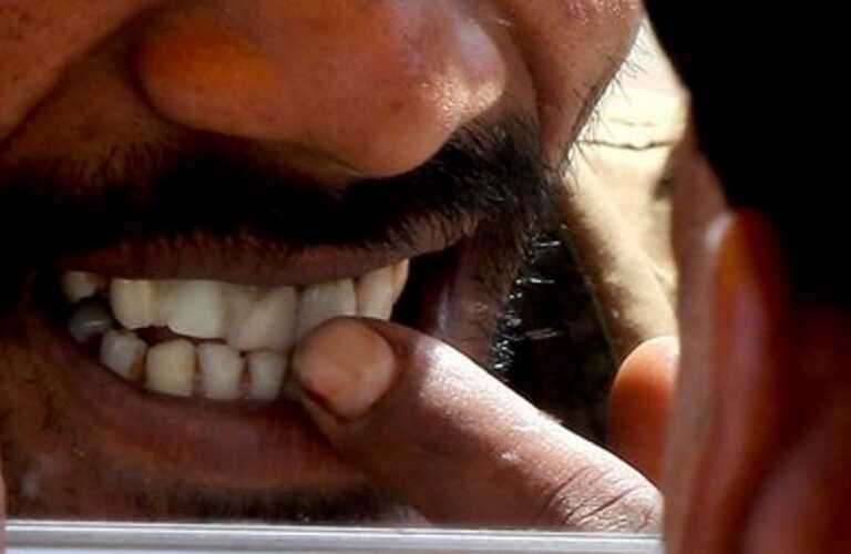 Η κακή υγεία των δοντιών μας αυξάνει τις πιθανότητες για άνοια