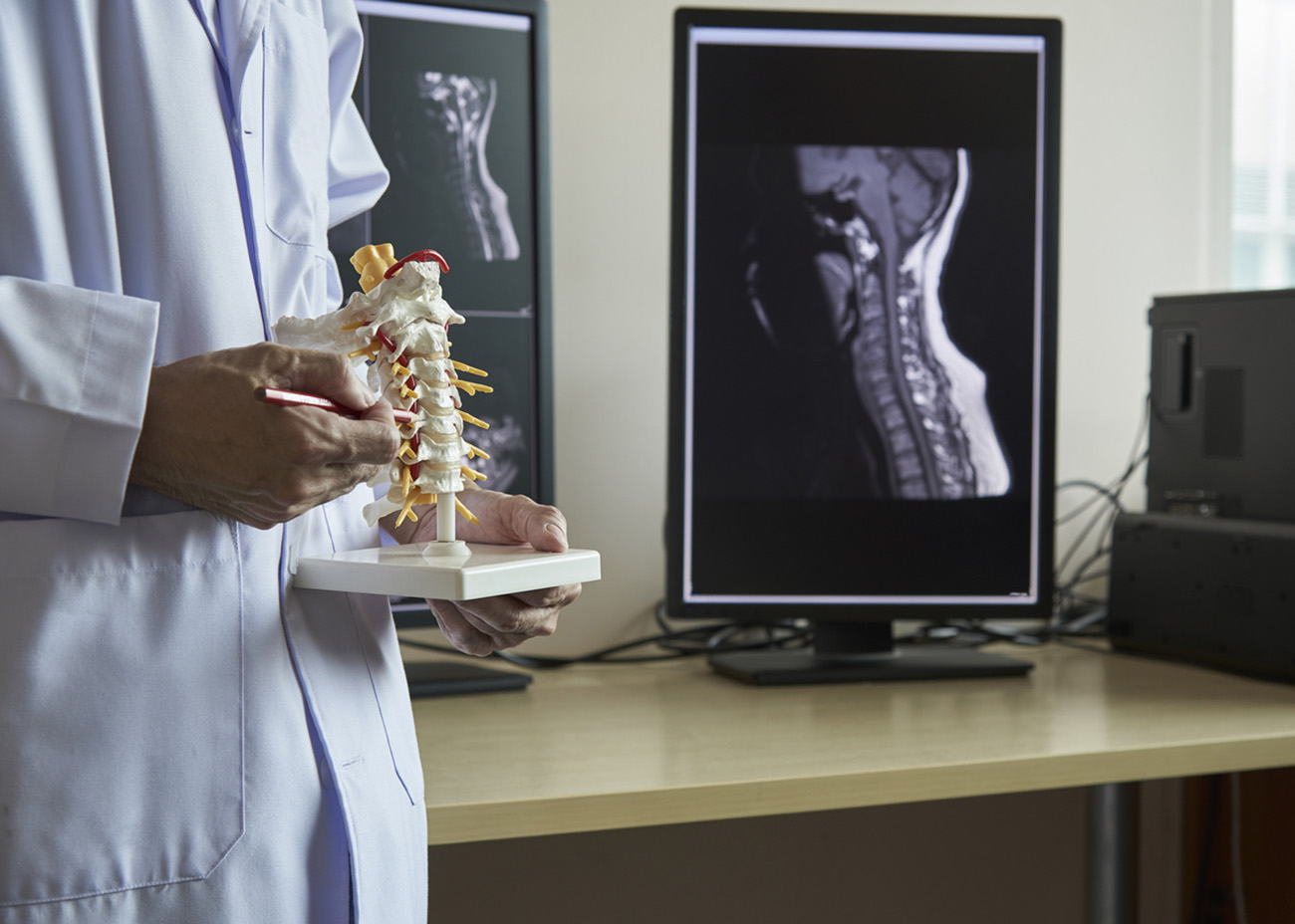 A neurosurgeon pointing at anatomy of human cervical spine model in medical office. Lumbar spine x-ray in computer screen on background.