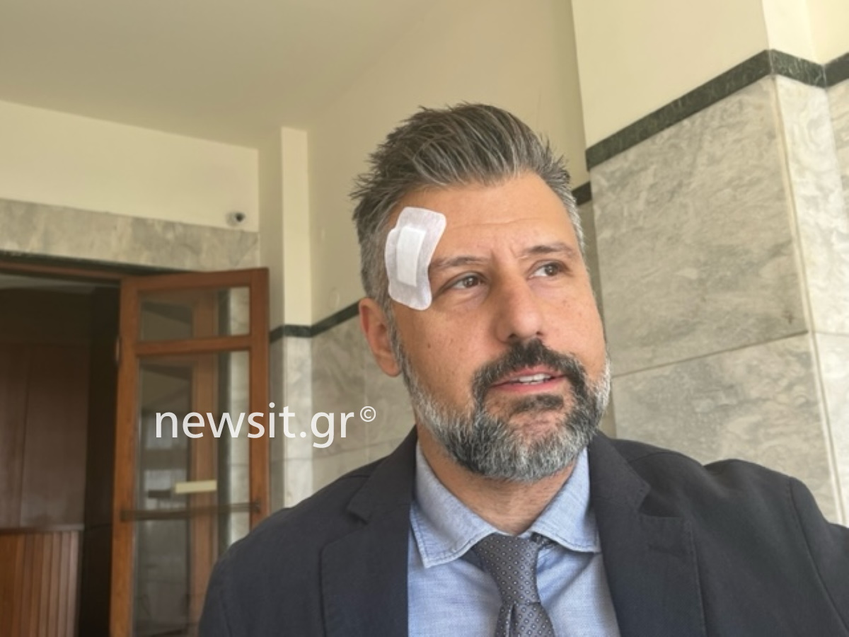 Θεσσαλονίκη: «Με χτυπούσαν με γροθιές και κλωτσιές» λέει ο γιατρός που ξυλοκοπήθηκε έξω από το ιατρείο του