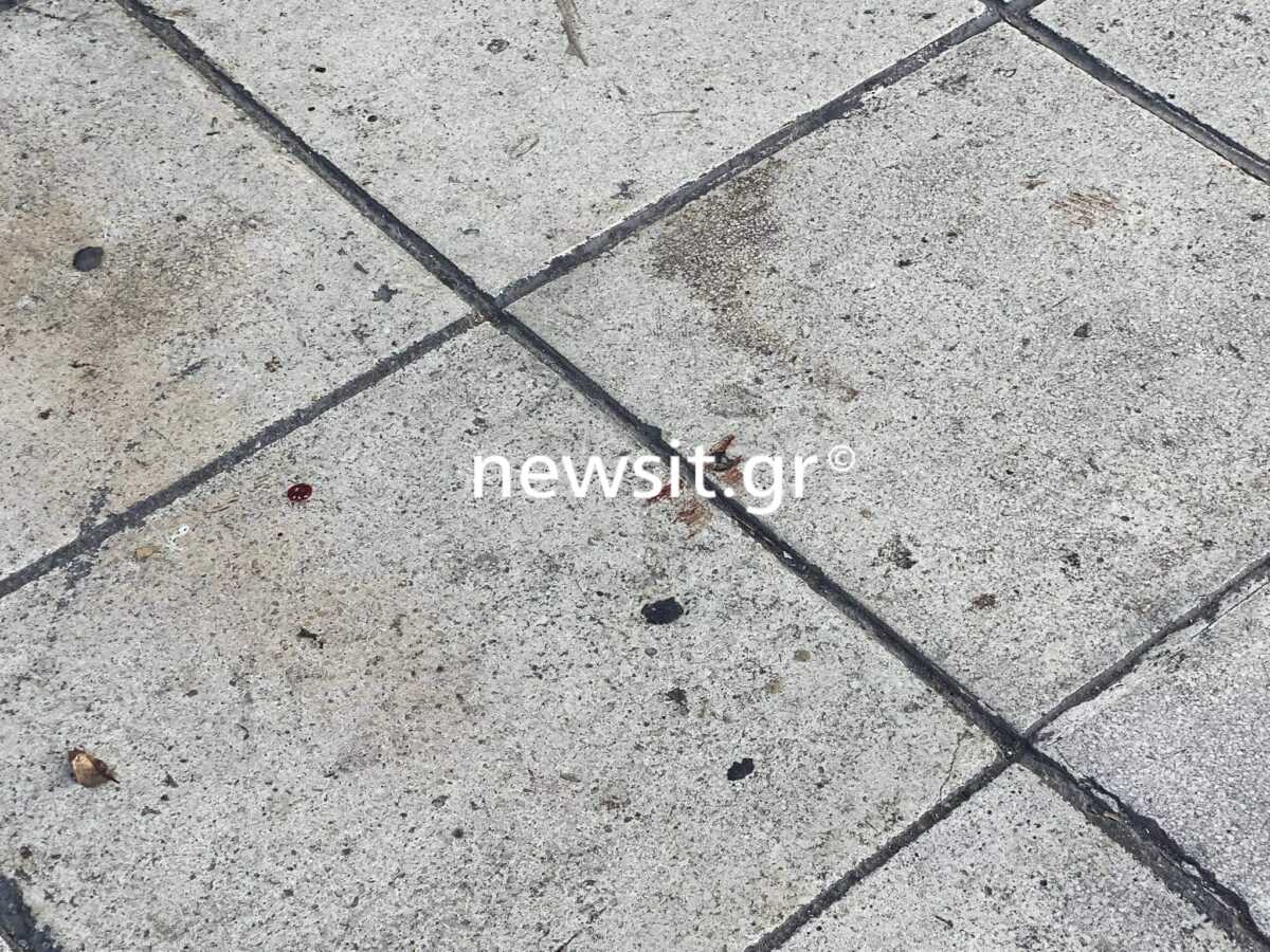 Θεσσαλονίκη: Τι λέει ο πλαστικός χειρουργός για την ενέδρα – «Αν δεν υπήρχε κόσμος θα με σκότωναν»