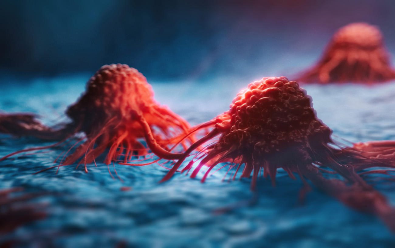 Cancer cells vis - 3d rendered image, enhanced scanning electron micrograph (SEM) of cancer cell. Visual of overall shape of the cell's surface at a very high magnification.  Medical research concept.