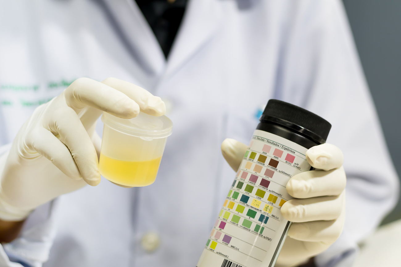 Doctor holding a container in hand, isolated on white background, Urine sample test.