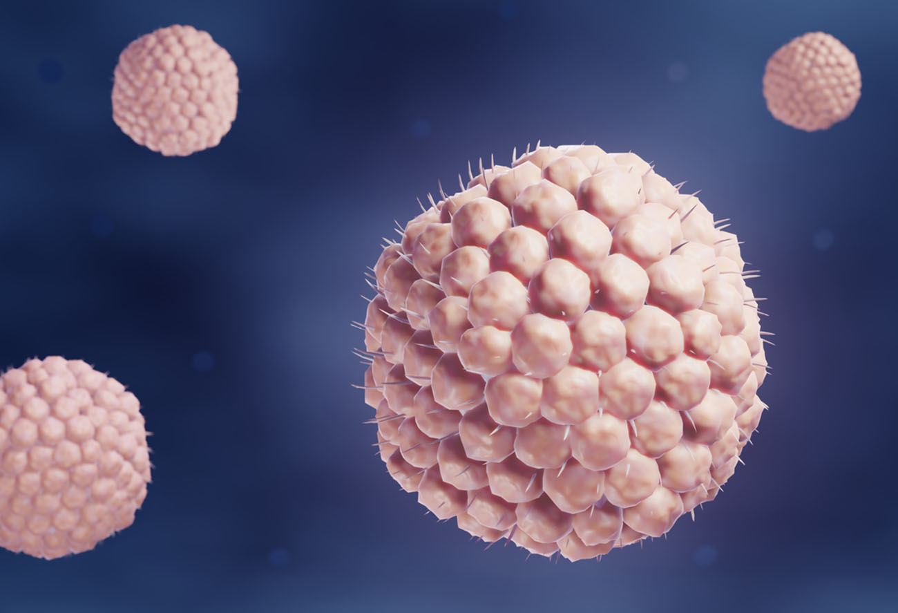 Varicella-zoster virus causing Chickenpox (varicella) or Shingles (herpes zoster)