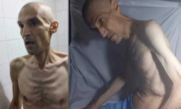 Οργή από τις φωτογραφίες «σκελετωμένου» γιατρού που κάνει απεργία πείνας σε φυλακή του Ιράν