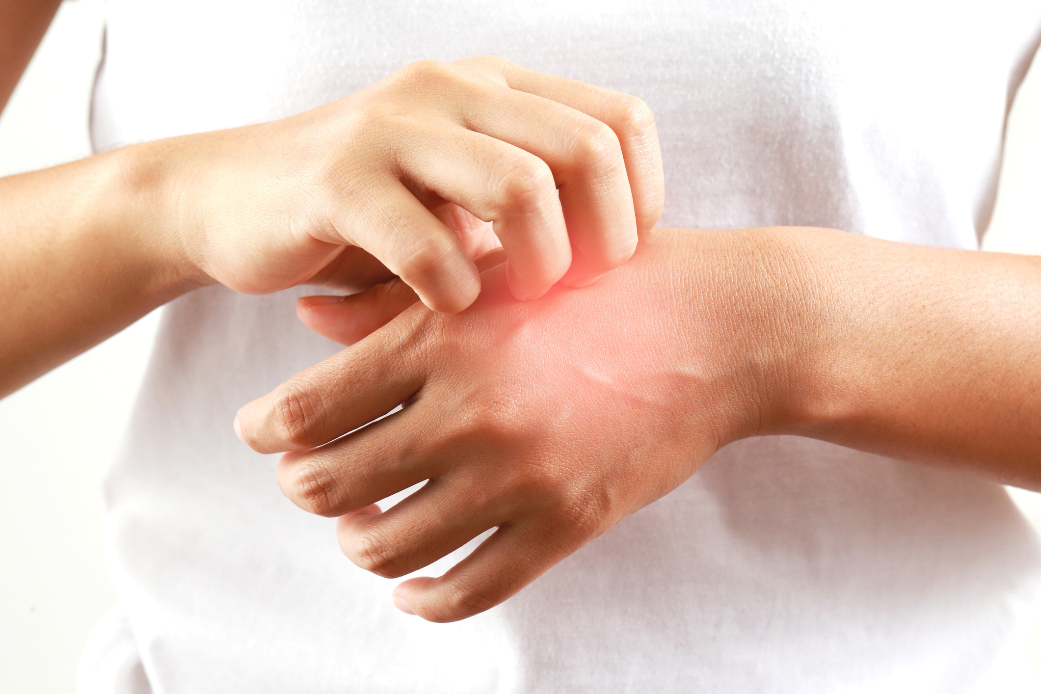 Most people suffer from skin allergies. The skin is quite dry and easily irritated. Just washing dishes, washing clothes, sometimes dry hands and rashes. Pay attention to your hands, which are the areas where chemicals are frequently touched.