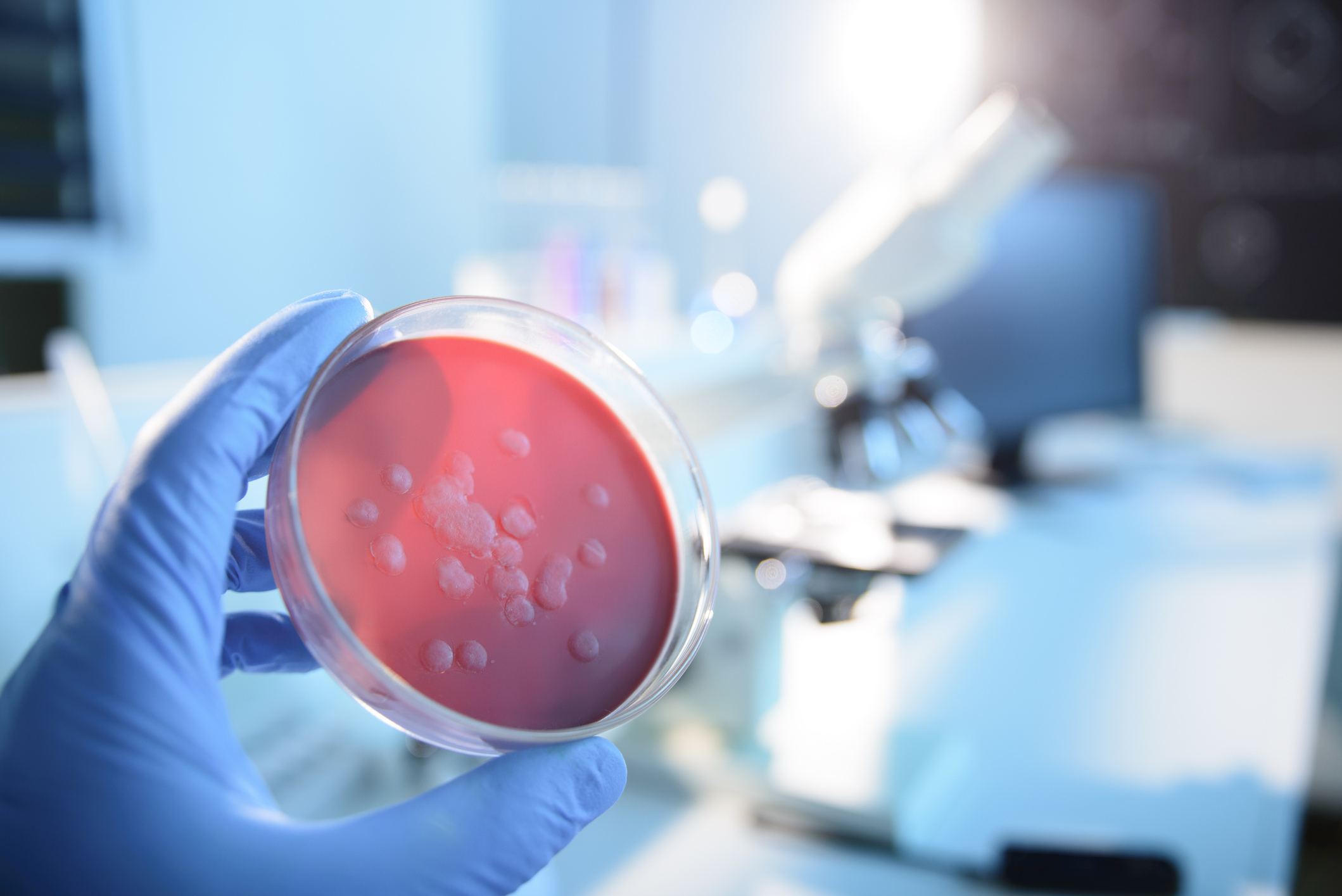 Scientist examining a microbiological culture
