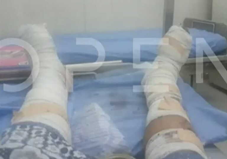 Φωτογραφία ντοκουμέντο από τα τραύματα του Έλληνα στο Σουδάν - Οι γιατροί δεν μπορούν να φτάσουν στο νοσοκομείο