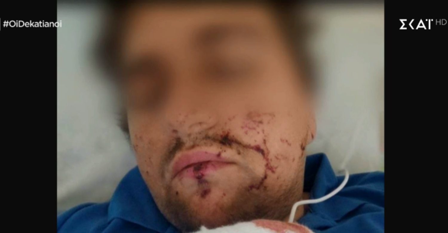 Τραυματίστηκε Έλληνας στρατιώτης που πολεμούσε στην Ουκρανία